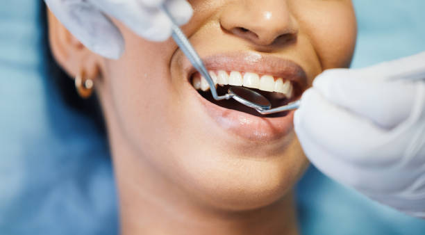 Best Emergency Dentist for Lost Fillings or Crowns in Midway, UT